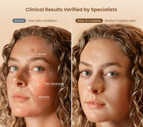 Rejuven Artemis Red Light Mask